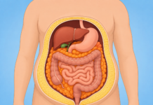 Visceral vs Subcutaneous Fat: What You Can Influence Visceral vs Subcutaneous Fat What You Can Influence